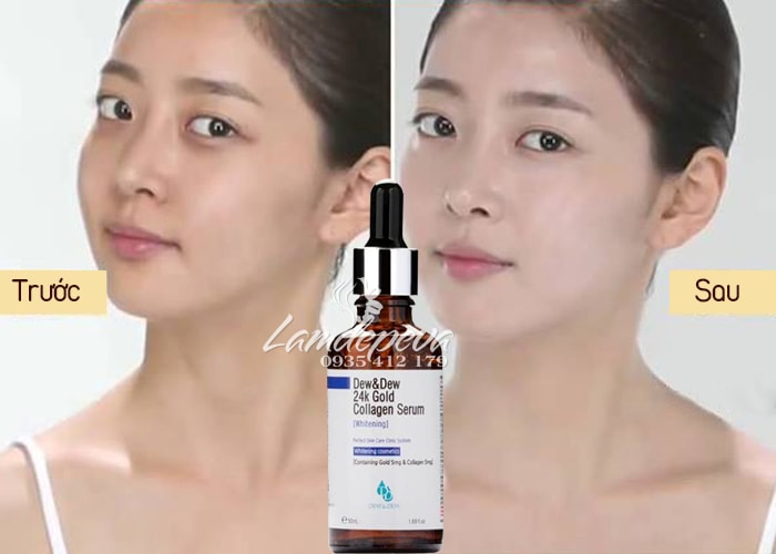 serum dưỡng trắng Dew & Dew 24K Gold Collagen Whitening 1