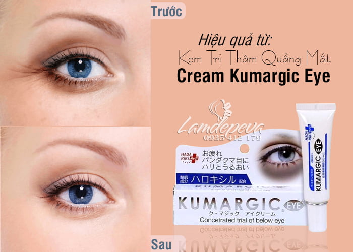 Kem trị quầng thâm mắt Kumargic Eye Cream 20g Nhật Bản 4