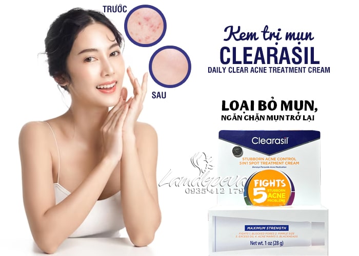 Kem trị mụn Clearasil Fights 5 Acne Maximum Strength của Mỹ 56