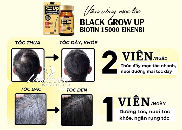 Viên uống mọc tóc Eikenbi Black Grow Up Biotin 15000 Nhật Bản 7